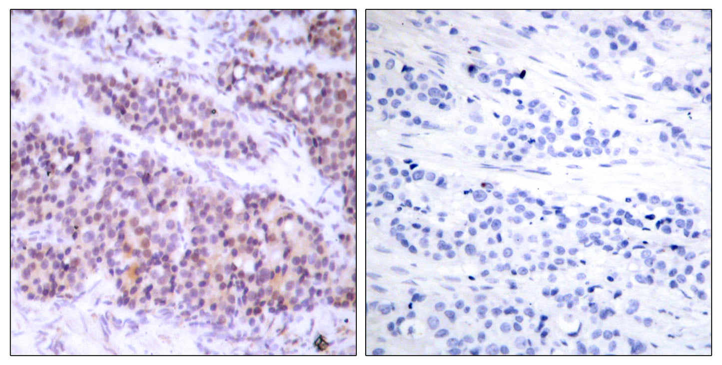 Bcl-x (phospho Ser62) Rabbit Polyclonal Antibody