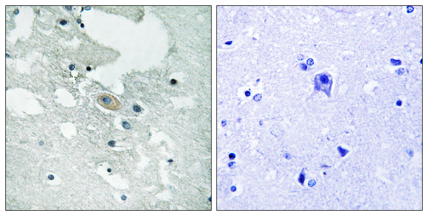 BLNK (phospho Tyr84) Rabbit Polyclonal Antibody