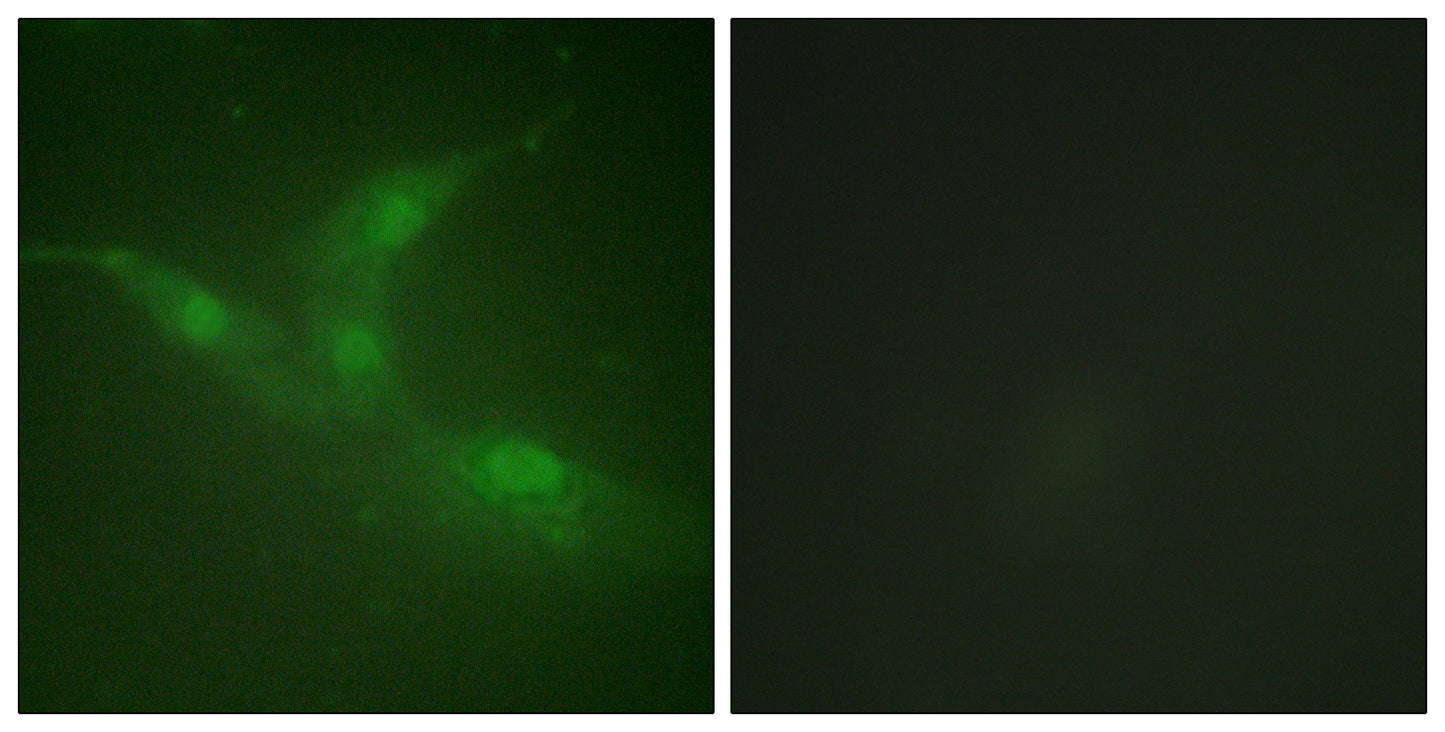 Brk (phospho Tyr447) Rabbit Polyclonal Antibody