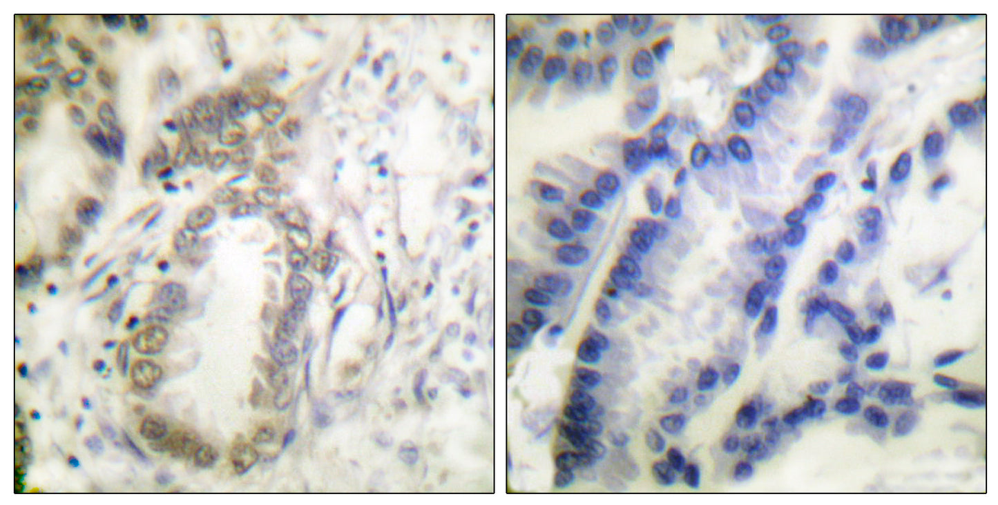 C/EBP α (phospho Ser21) Rabbit Polyclonal Antibody