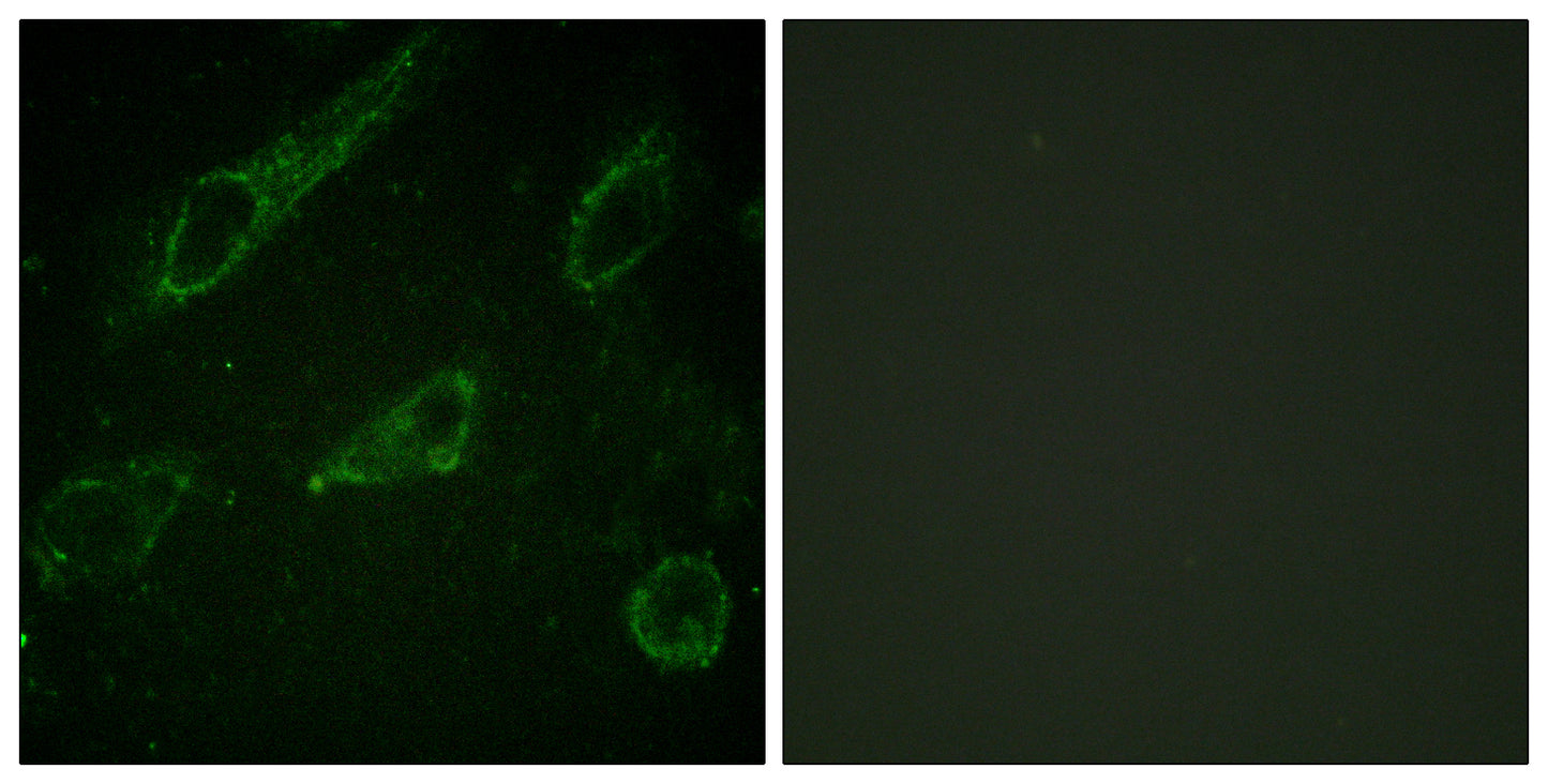 c-Abl (phospho Tyr245) Rabbit Polyclonal Antibody