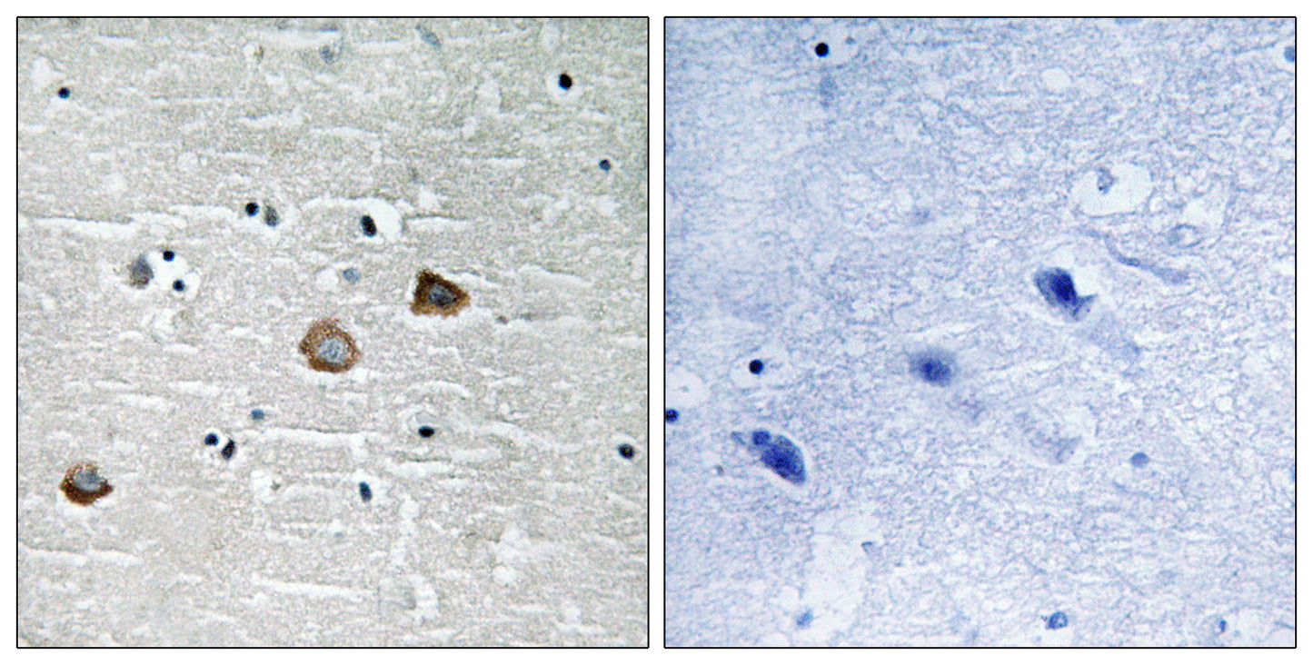 CaMKIIβ/γ/δ (phospho Thr287) Rabbit Polyclonal Antibody