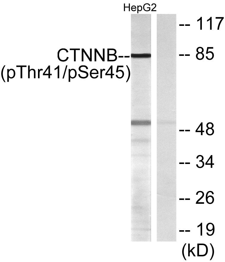 Catenin-β (phospho Thr41/S45) Rabbit Polyclonal Antibody