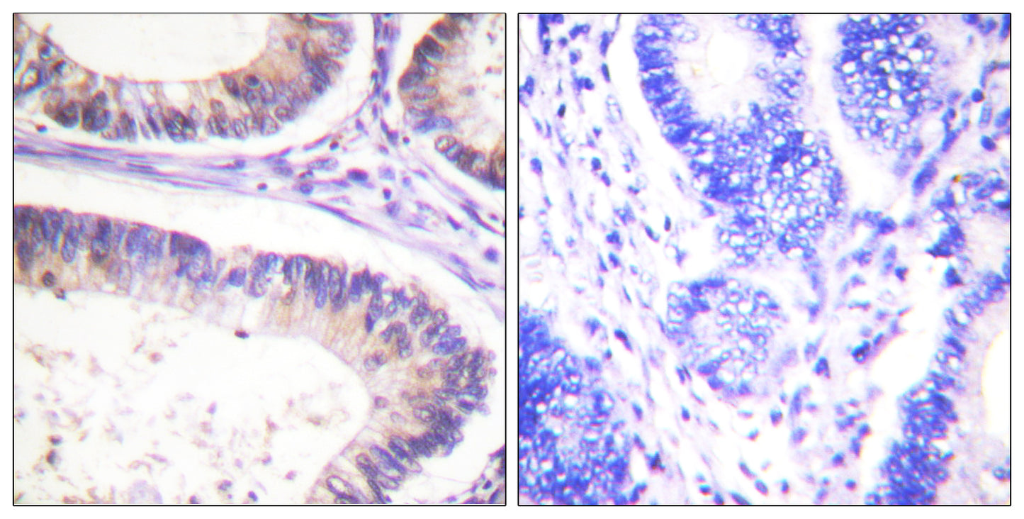 Cbl (phospho Tyr674) Rabbit Polyclonal Antibody
