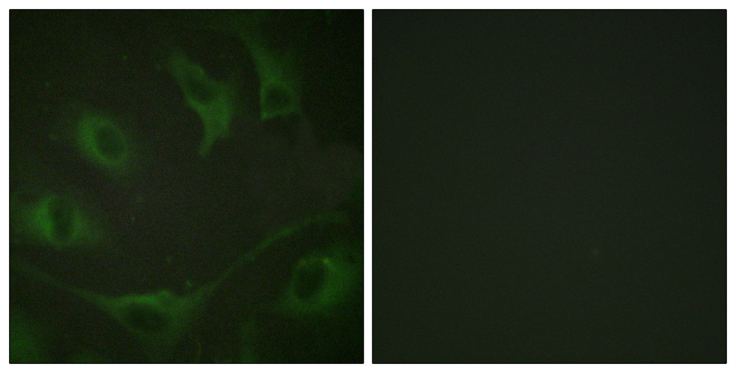 Cbl (phospho Tyr774) Rabbit Polyclonal Antibody