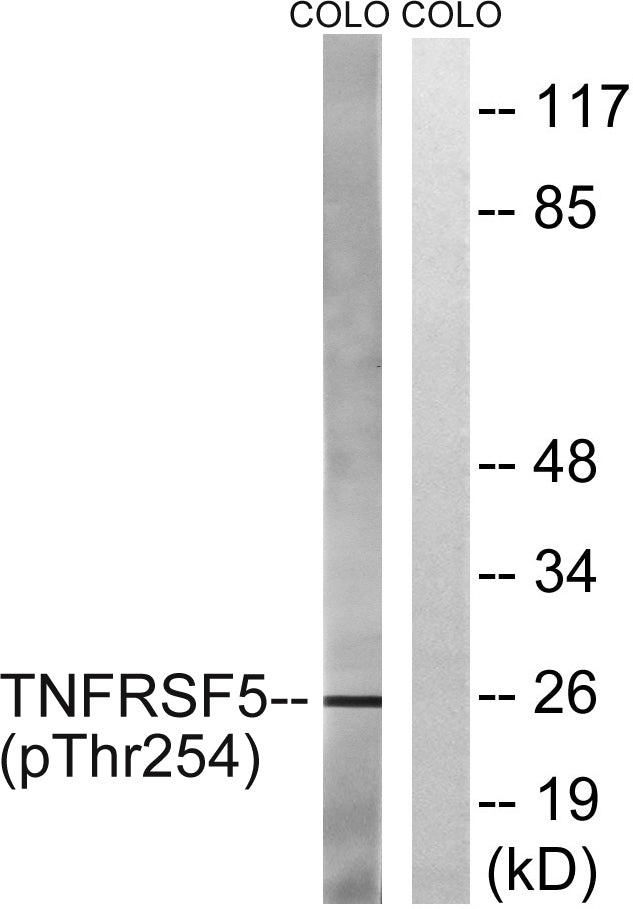 CD40 (phospho Thr254) Rabbit Polyclonal Antibody