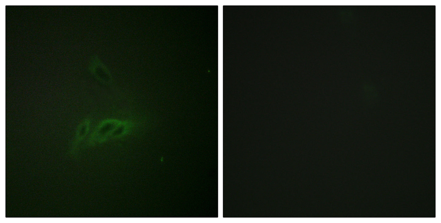 CD45 (phospho Ser1007) Rabbit Polyclonal Antibody