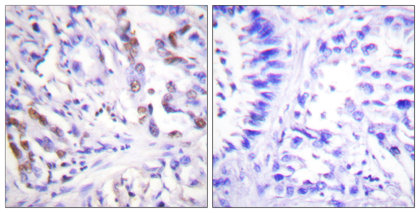 Cdc25A (phospho Ser75) Rabbit Polyclonal Antibody