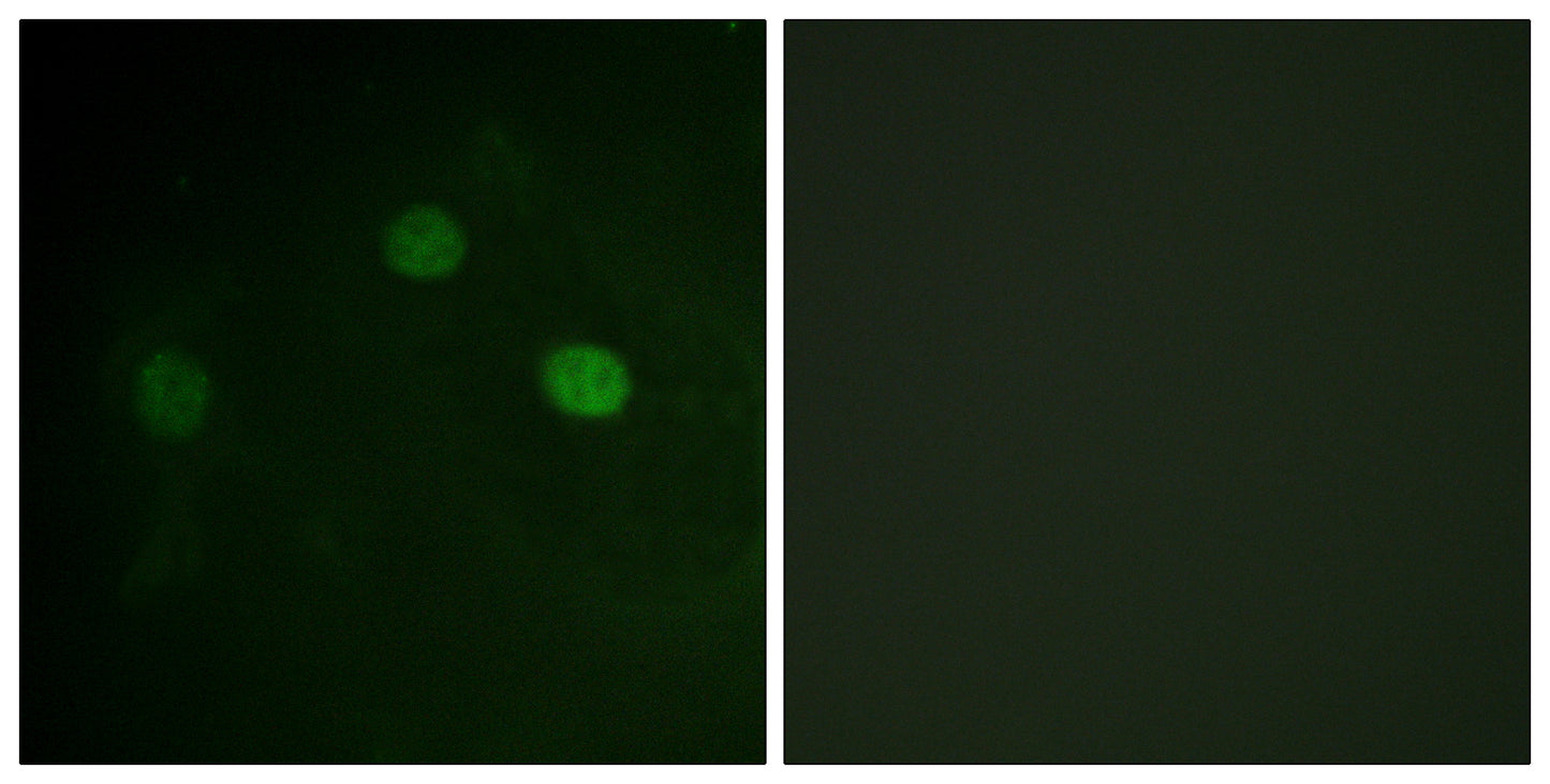 Cdk1/2/3 (phospho Thr14) Rabbit Polyclonal Antibody