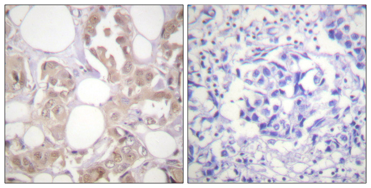 Cdk7 (phospho Thr170) Rabbit Polyclonal Antibody