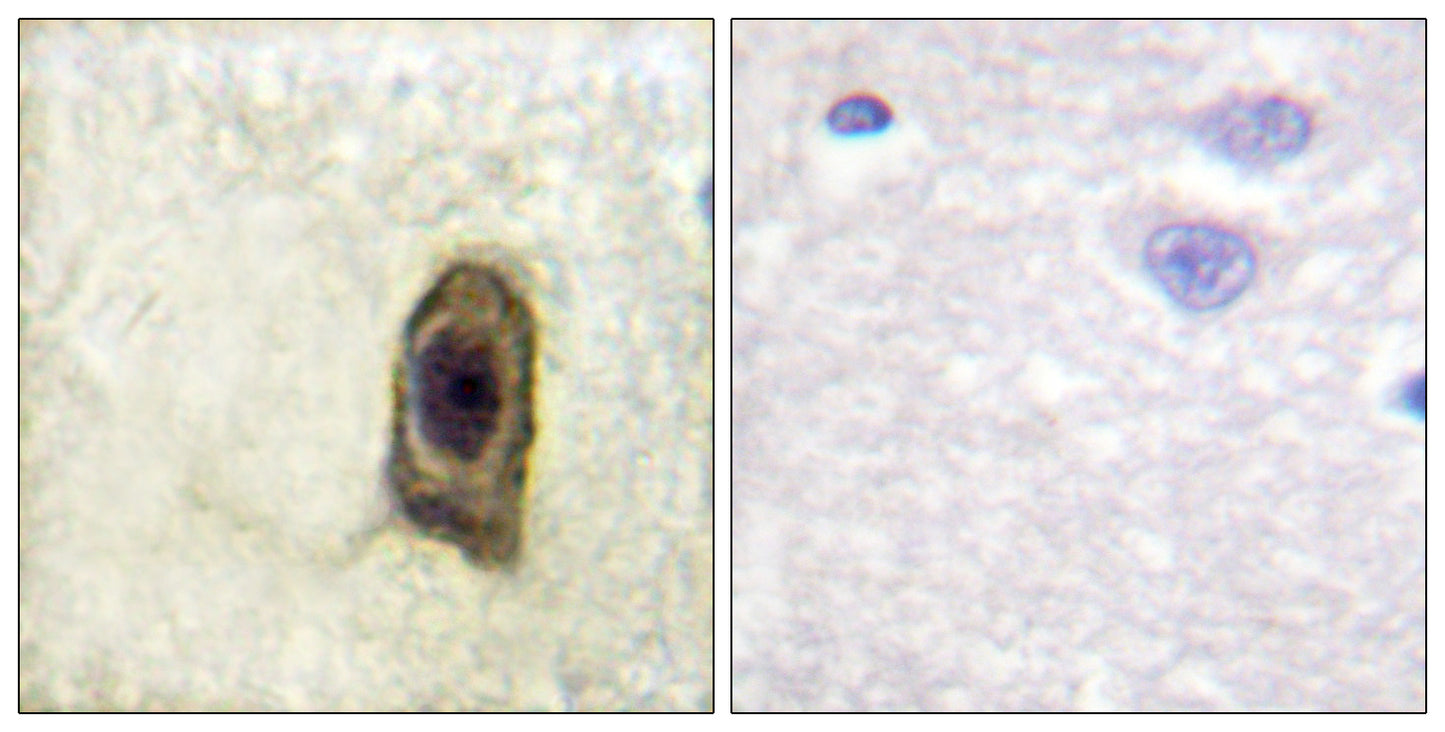 c-Fms (phospho Tyr561) Rabbit Polyclonal Antibody