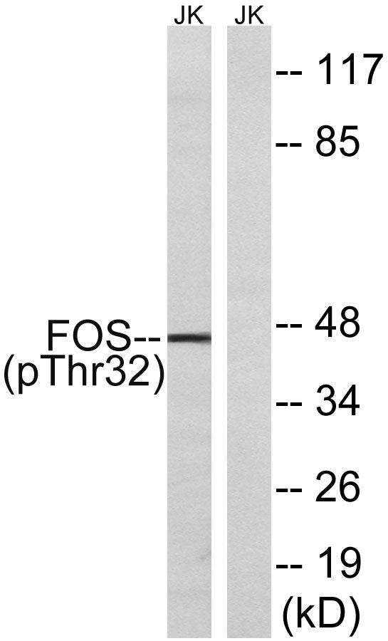 c-Fos (phospho Ser32) Rabbit Polyclonal Antibody