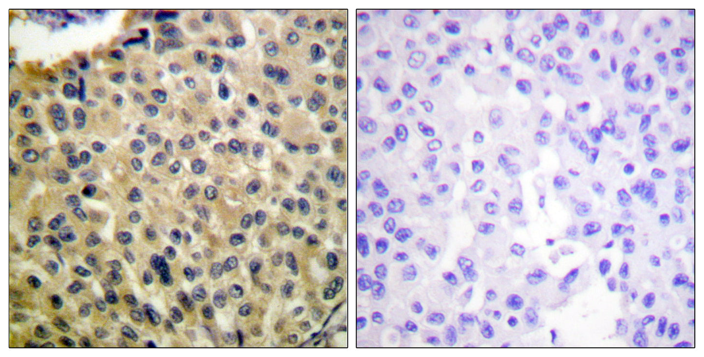 c-Kit (phospho Tyr703) Rabbit Polyclonal Antibody