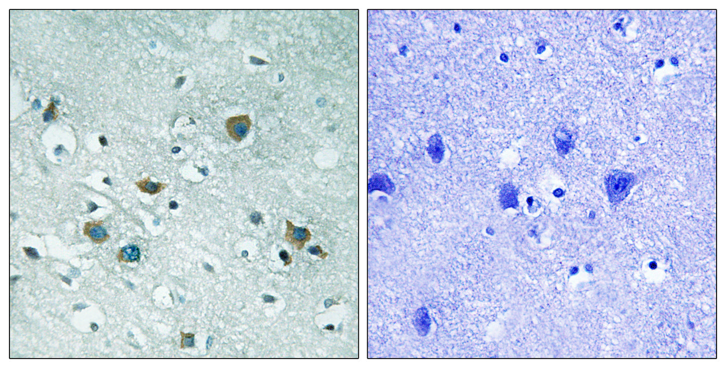 CRMP-2 (phospho Thr509) Rabbit Polyclonal Antibody