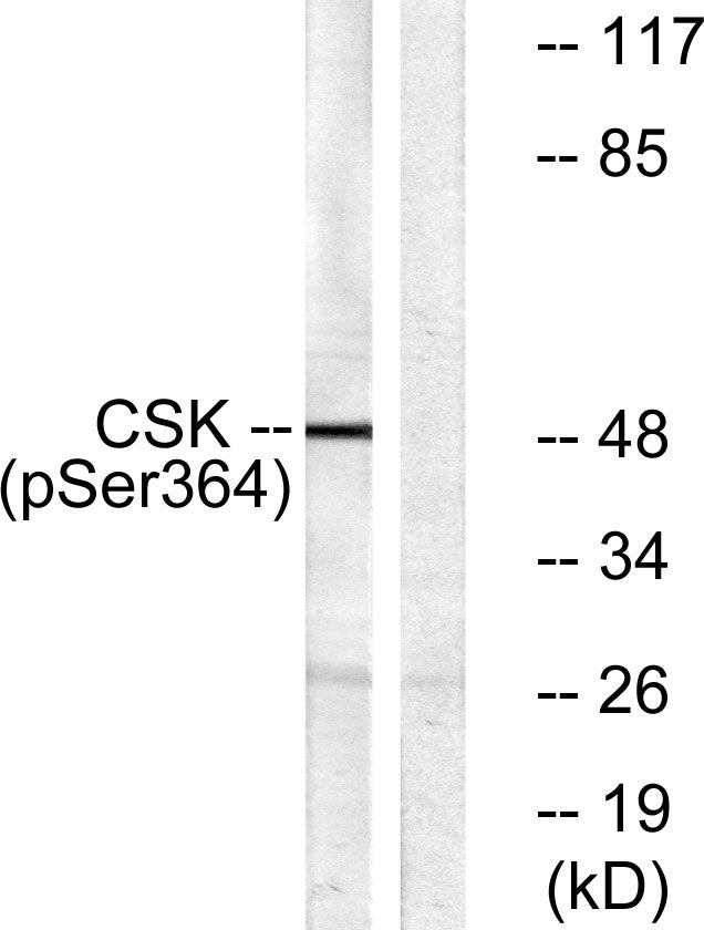Csk (phospho Ser364) Rabbit Polyclonal Antibody
