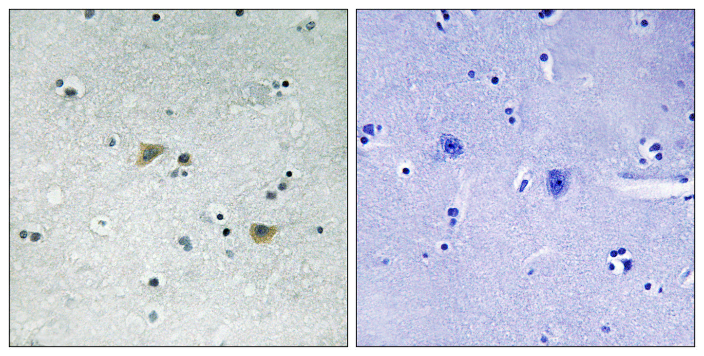 c-Src (phospho Ser75) Rabbit Polyclonal Antibody
