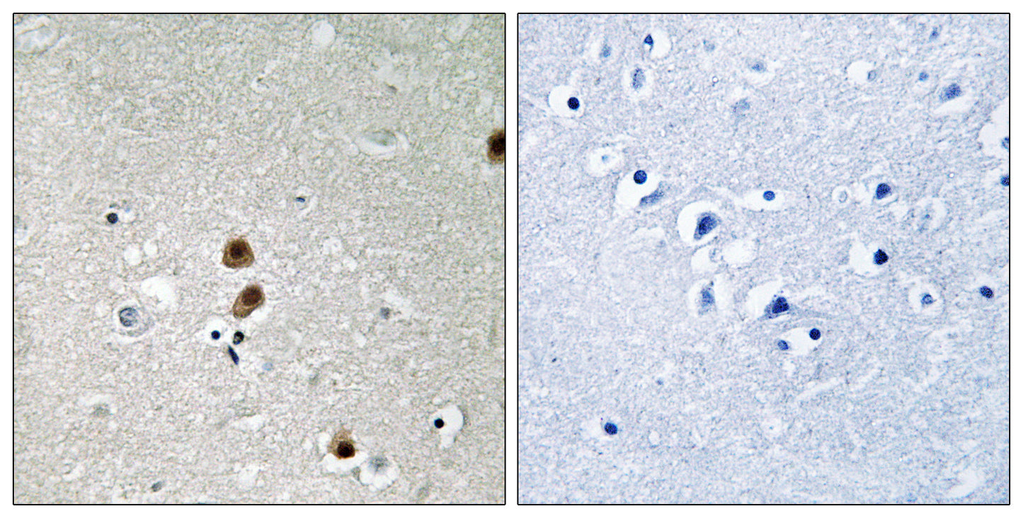 CtBP1 (phospho Ser422) Rabbit Polyclonal Antibody