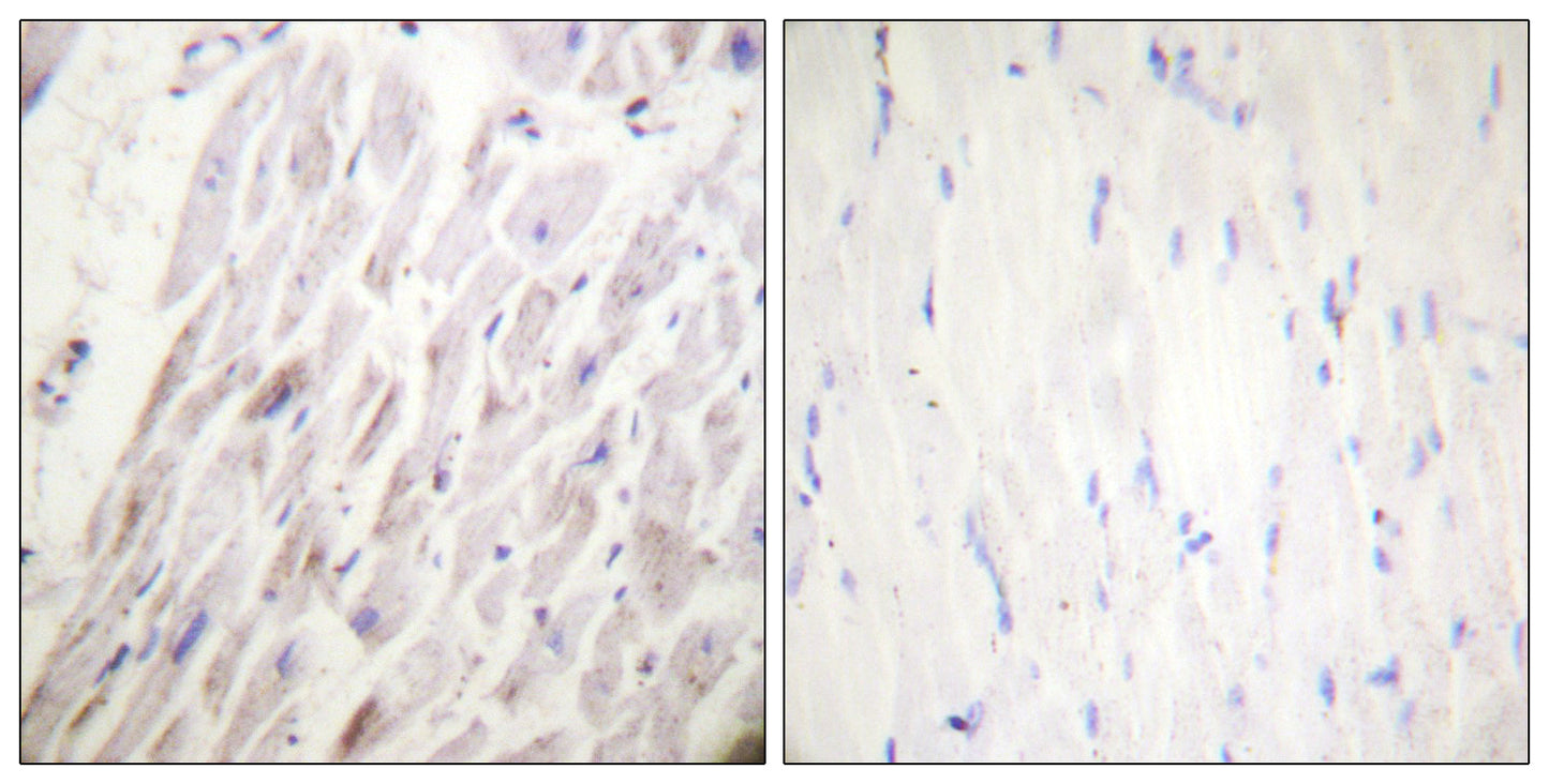 Dematin (phospho Ser403) Rabbit Polyclonal Antibody