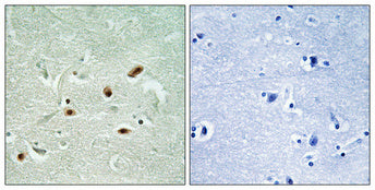 DNA-PKCS (phospho Ser2612) Rabbit Polyclonal Antibody