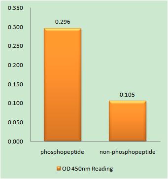 Doublecortin (phospho Ser339) Rabbit Polyclonal Antibody