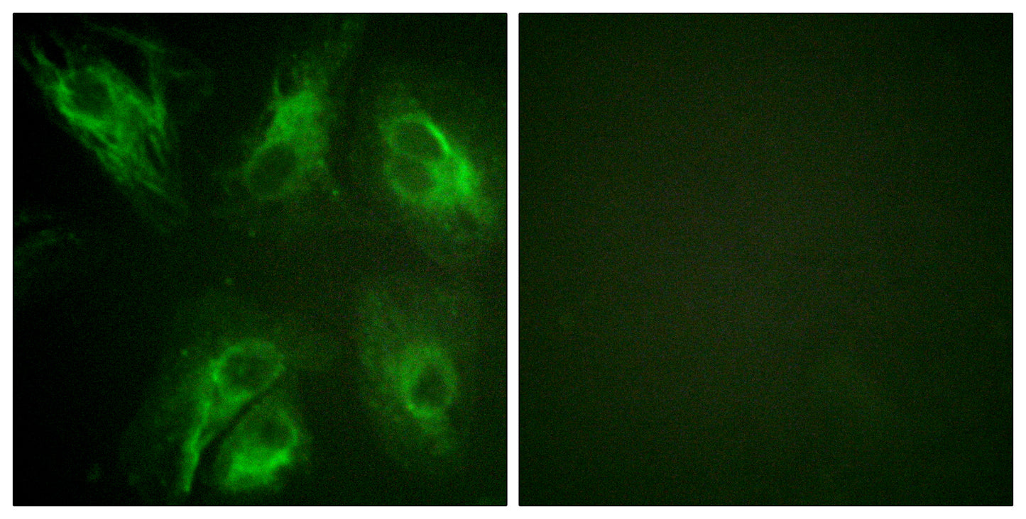 DREAM (phospho Ser63) Rabbit Polyclonal Antibody