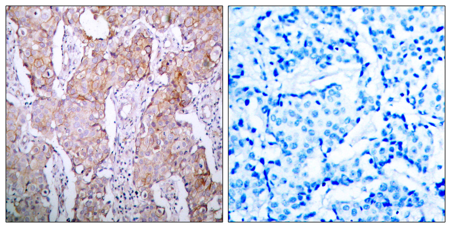 EGFR (phospho Ser1070) Rabbit Polyclonal Antibody