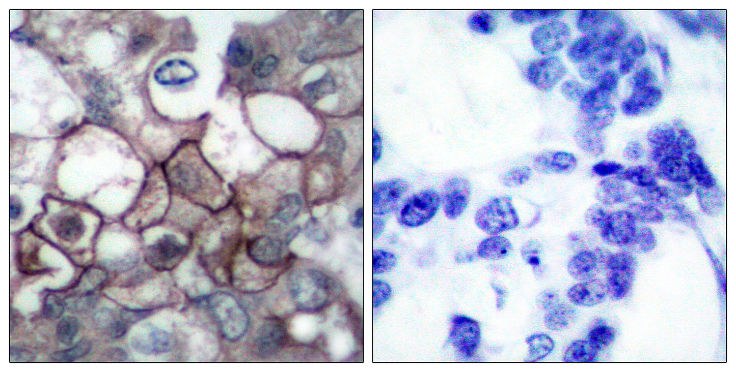 EGFR (phospho Tyr1197) Rabbit Polyclonal Antibody