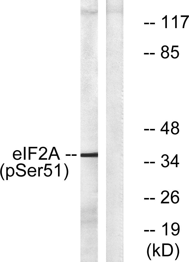 eIF2α (phospho Ser51) Rabbit Polyclonal Antibody
