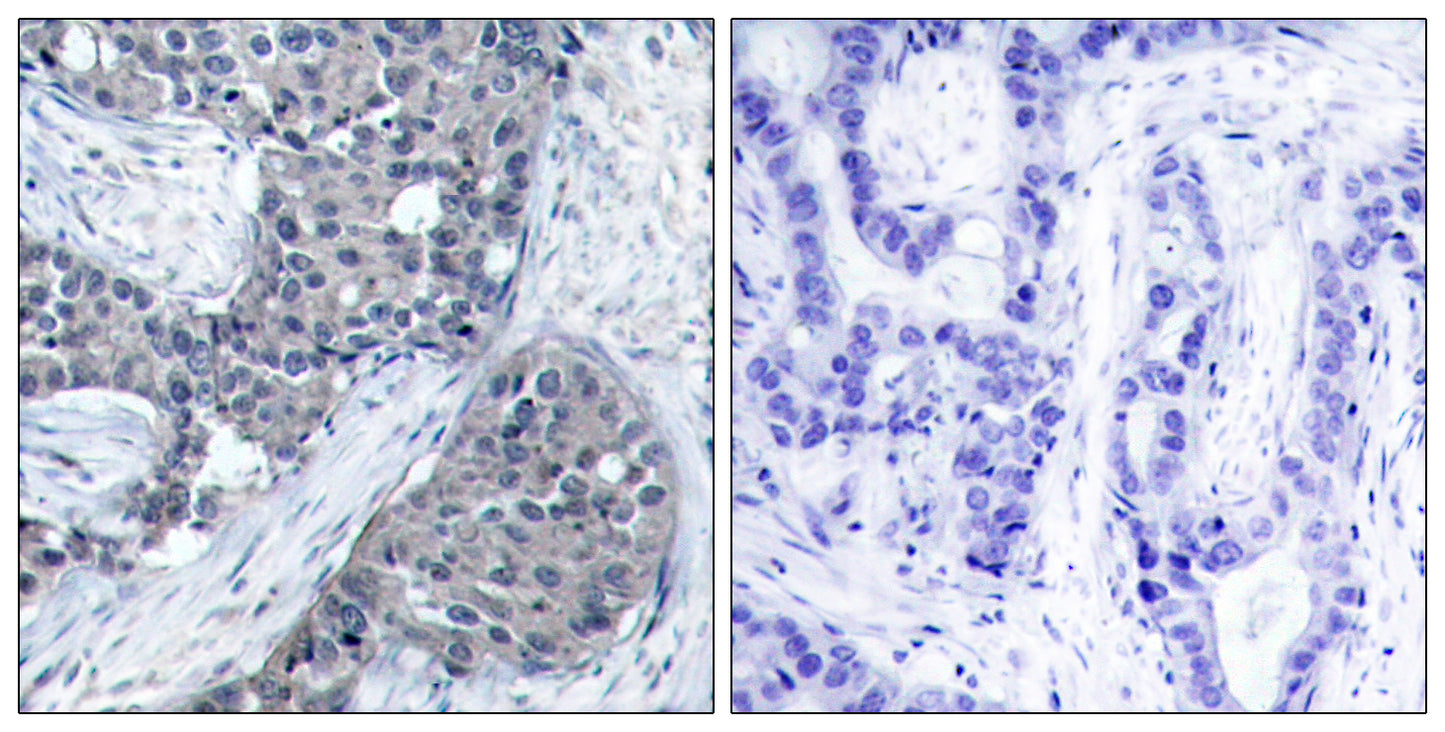 eIF4E (phospho Ser209) Rabbit Polyclonal Antibody