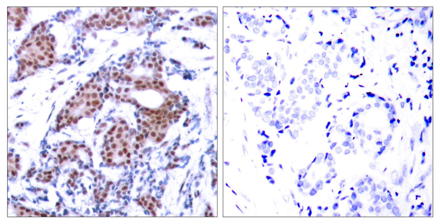 Elk-1 (phospho Ser383) Rabbit Polyclonal Antibody