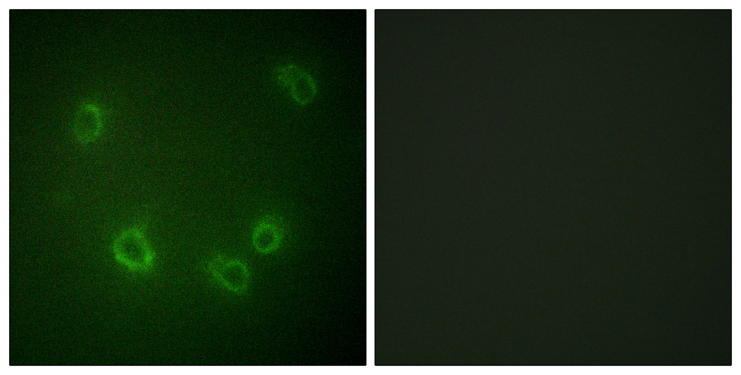 ENaC β (phospho Thr615) Rabbit Polyclonal Antibody
