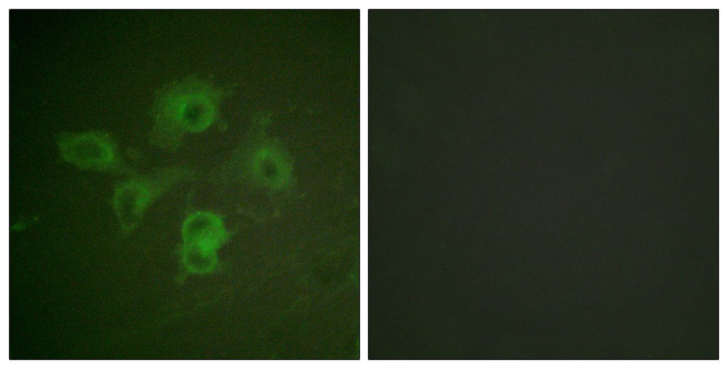 EphB1/2 (phospho Tyr594/604) Rabbit Polyclonal Antibody