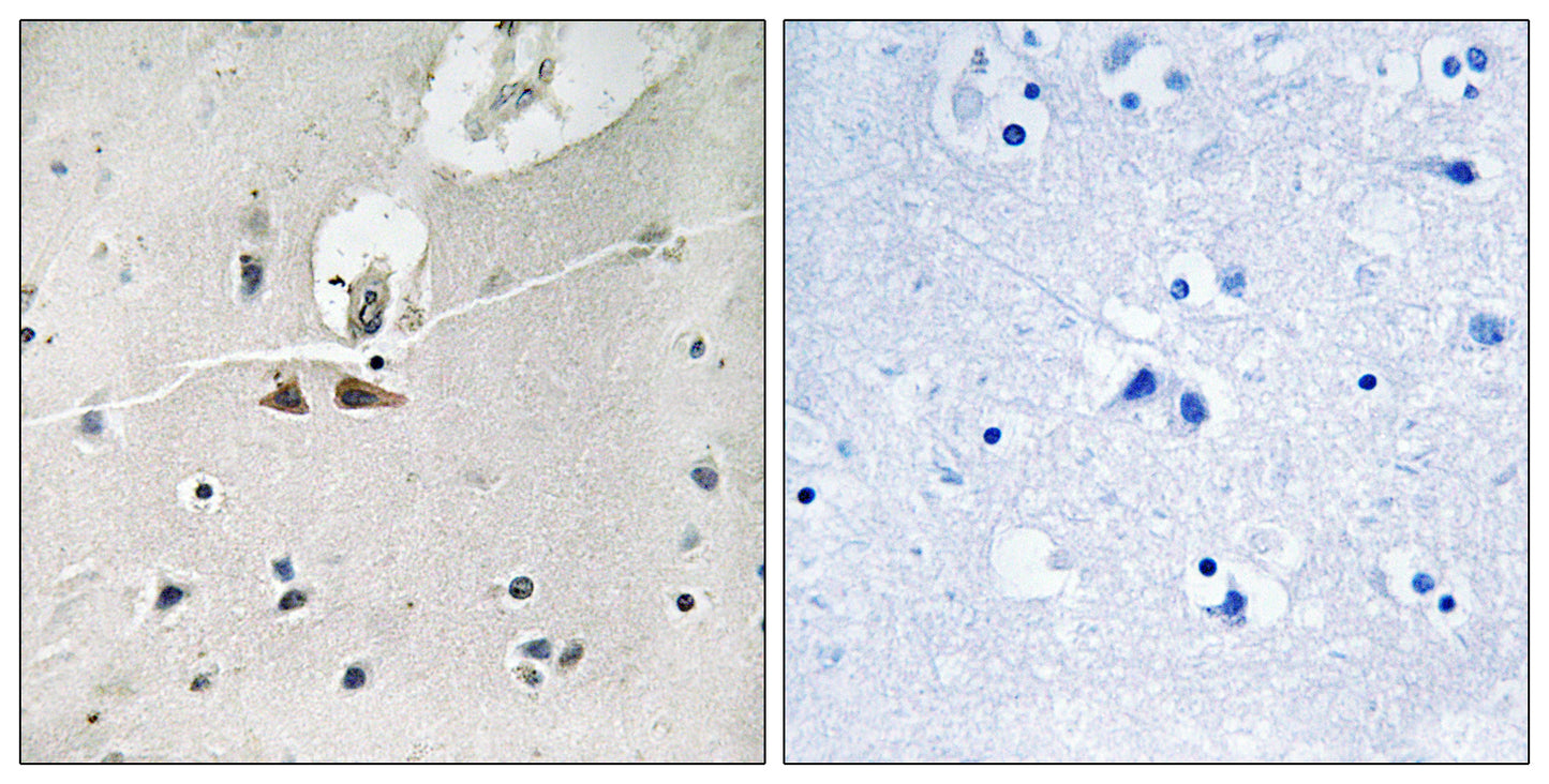 Ephrin-B1/2/3 (phospho Tyr324) Rabbit Polyclonal Antibody