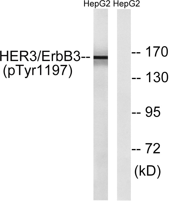 ErbB-3 (phospho Tyr1197) Rabbit Polyclonal Antibody