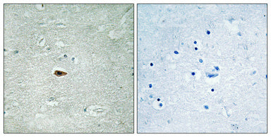 ErbB-3 (phospho Tyr1328) Rabbit Polyclonal Antibody