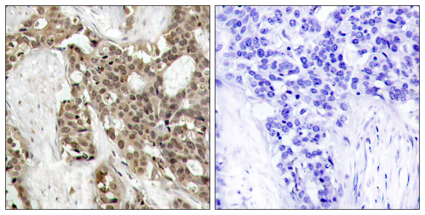 ERK 1/2 (phospho Tyr204) Rabbit Polyclonal Antibody