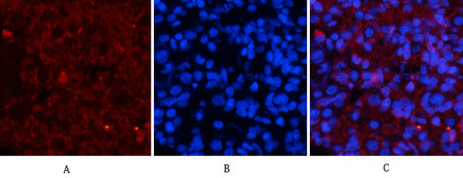 ERK 1/2 (phospho Tyr222/205) Rabbit Polyclonal Antibody