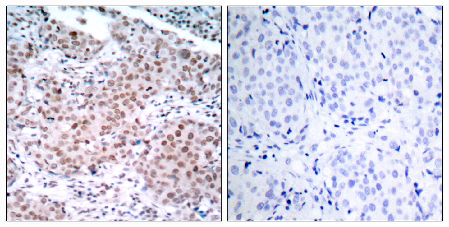 ERα (phospho Ser104) Rabbit Polyclonal Antibody