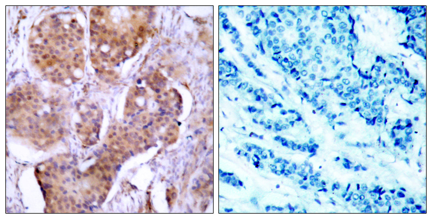 ERα (phospho Ser106) Rabbit Polyclonal Antibody