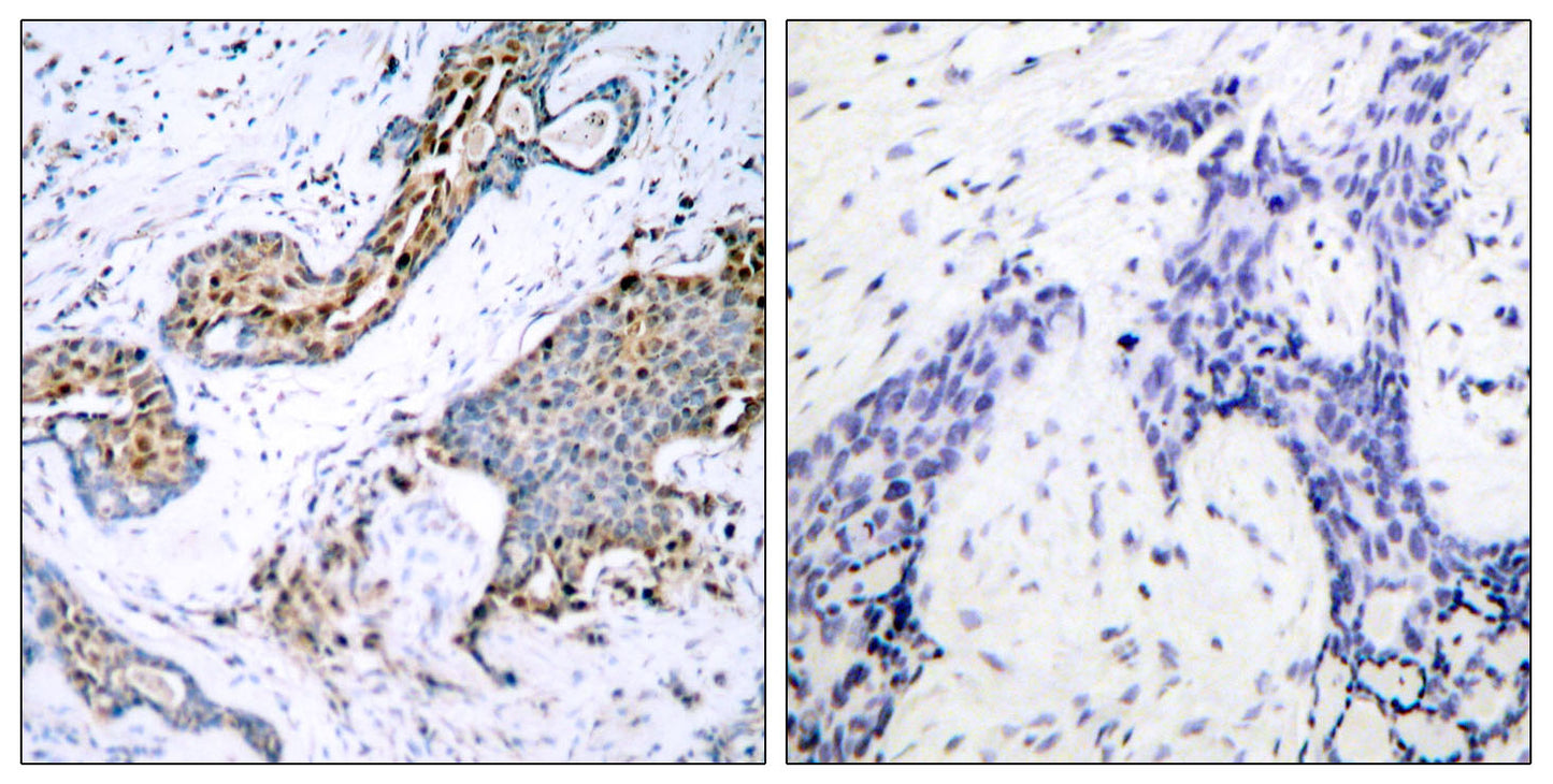 ERα (phospho Ser118) Rabbit Polyclonal Antibody