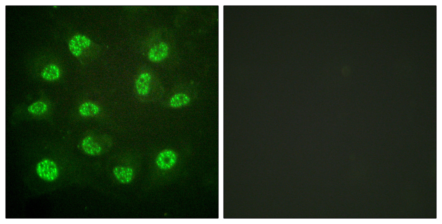 ERβ (phospho Ser105) Rabbit Polyclonal Antibody