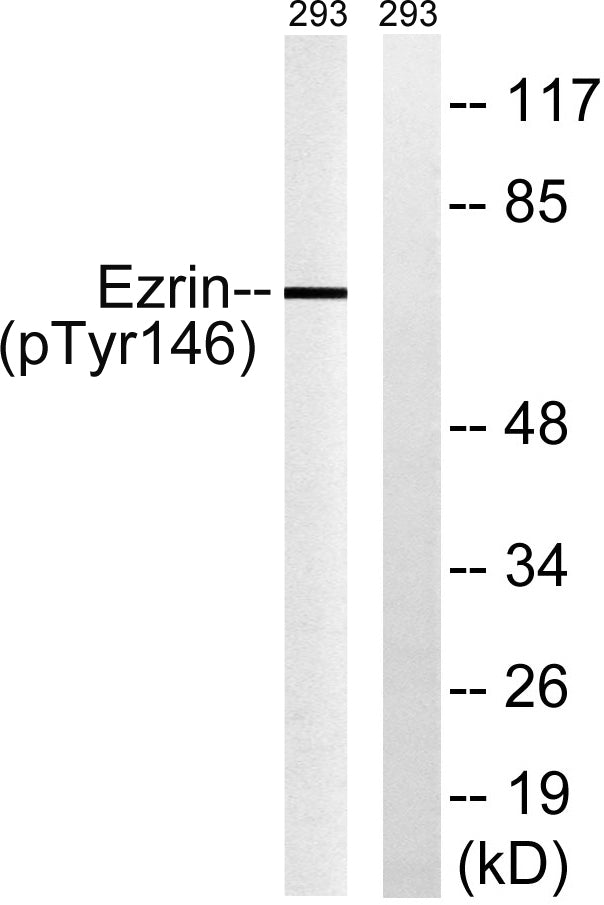 Ezrin (phospho Tyr146) Rabbit Polyclonal Antibody