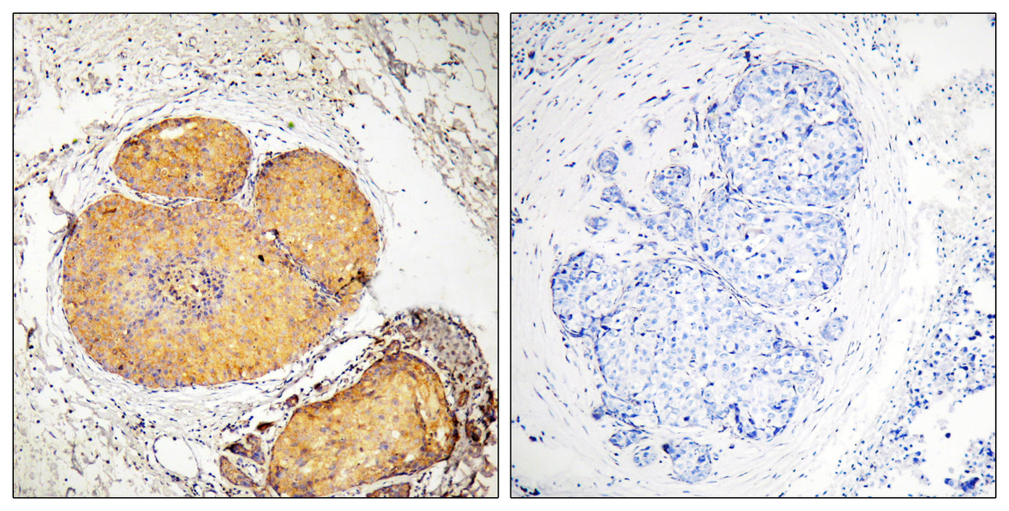 FADD (phospho Ser191) Rabbit Polyclonal Antibody