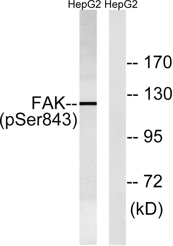 FAK (phospho Ser843) Rabbit Polyclonal Antibody