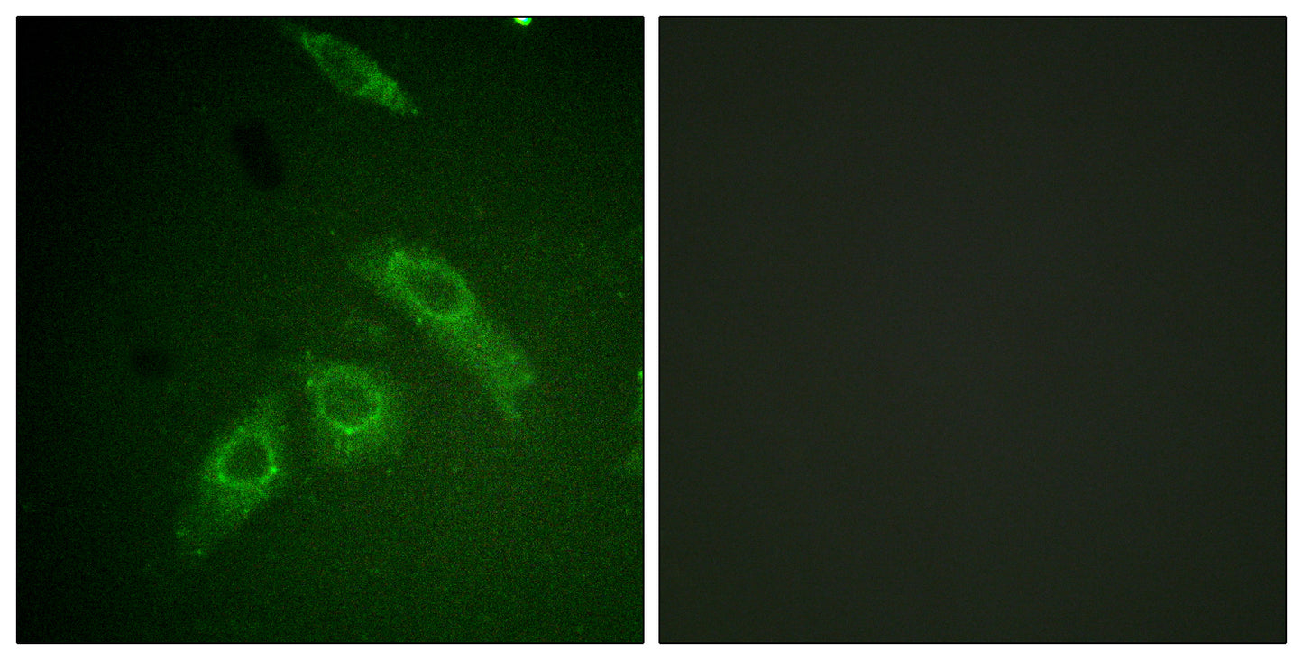FAK (phospho Ser910) Rabbit Polyclonal Antibody