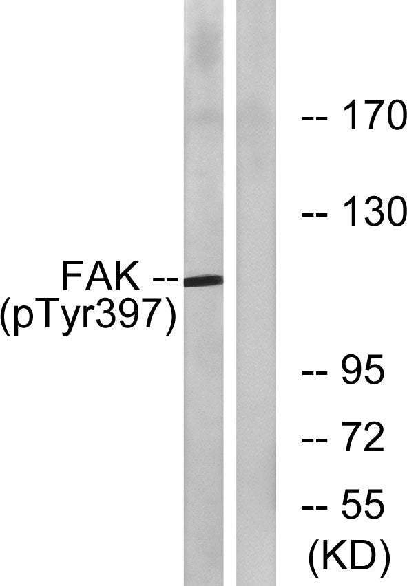FAK (phospho Tyr397) Rabbit Polyclonal Antibody