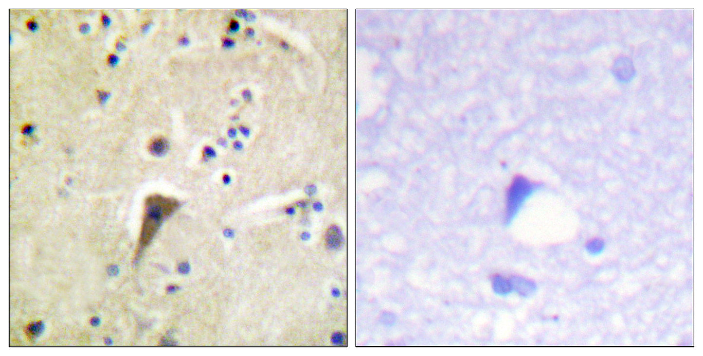 FAK (phospho Tyr397) Rabbit Polyclonal Antibody