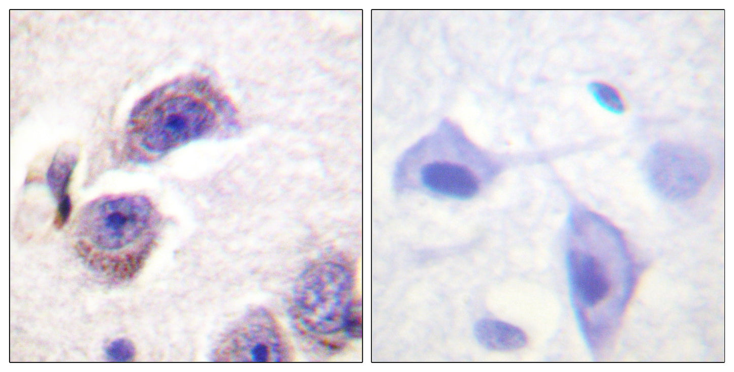 FAK (phospho Tyr407) Rabbit Polyclonal Antibody