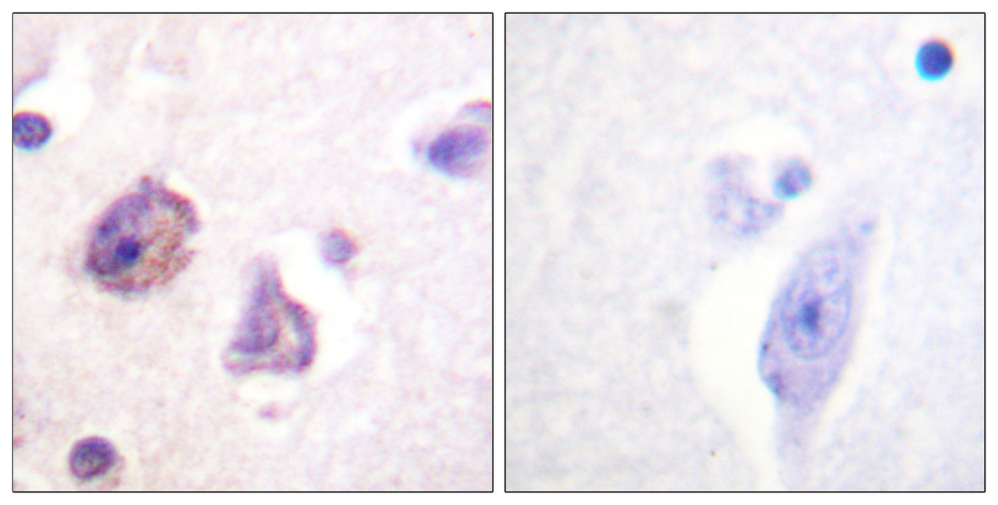 FAK (phospho Tyr576) Rabbit Polyclonal Antibody