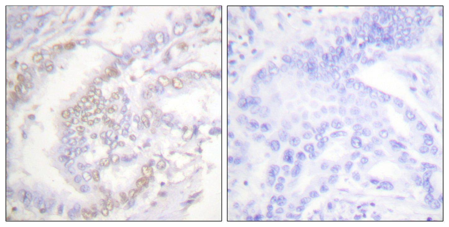 FANCD2 (phospho Ser222) Rabbit Polyclonal Antibody